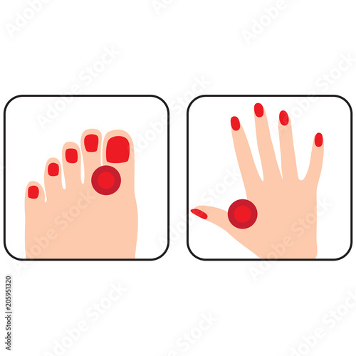 Painful and inflamed foot and hand