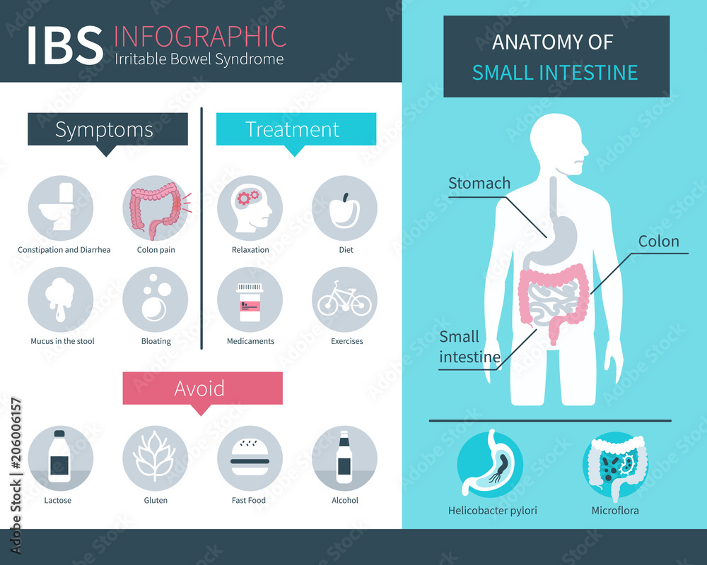 ibs infographic Stock Vector | Adobe Stock