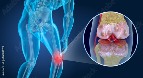 Photos Knee pain Attack, man suffering from knee. 3D illustration