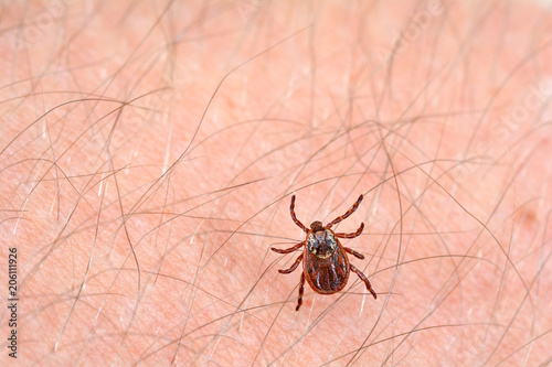 Danger of tick bite. Mite on the skin