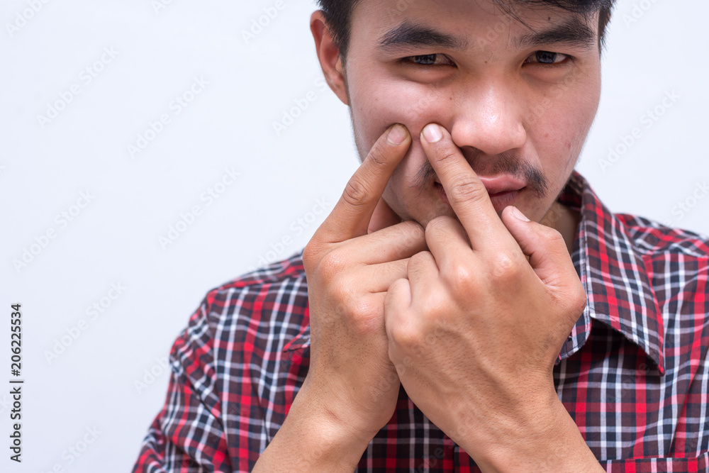 Portrait of Men are the pimples on his face. isolated indoors white background. Portrait of Men are the pimples on his face. isolated indoors white background.