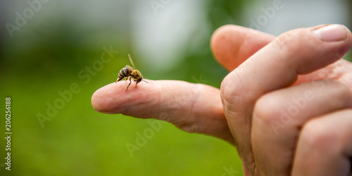 the bee stings the person in the finger