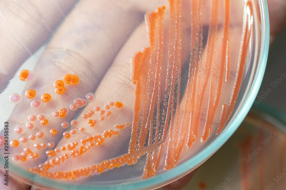 Serratia marcescens is a species of rodshaped gramnegative bacteria