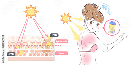 woman with sunburn problem