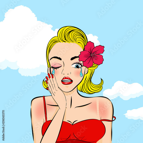 woman with sunburn