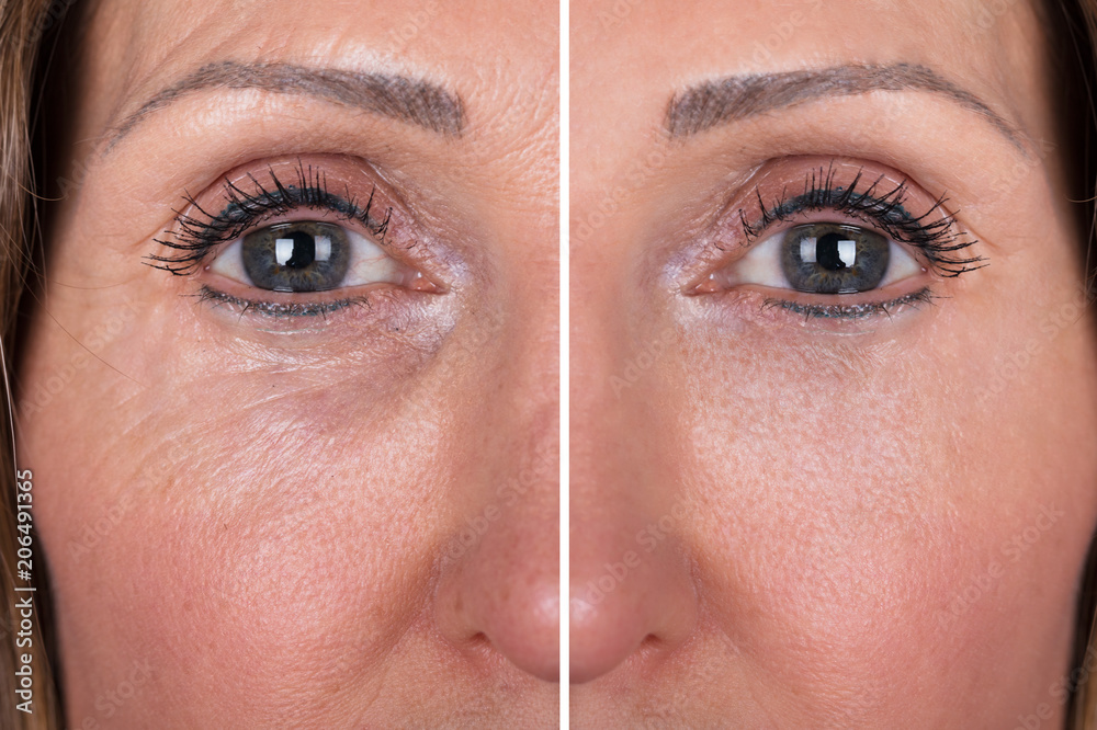 Fototapeta premium Woman With Before And After Rejuvenation