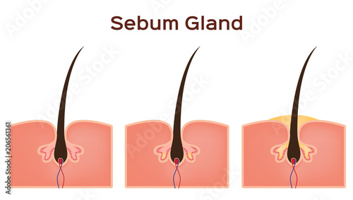 sebum oil gland in human skin vector photo