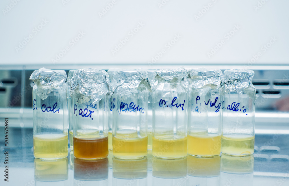 Liquid culture of bacteria in test tubes. The culture of Escherichia