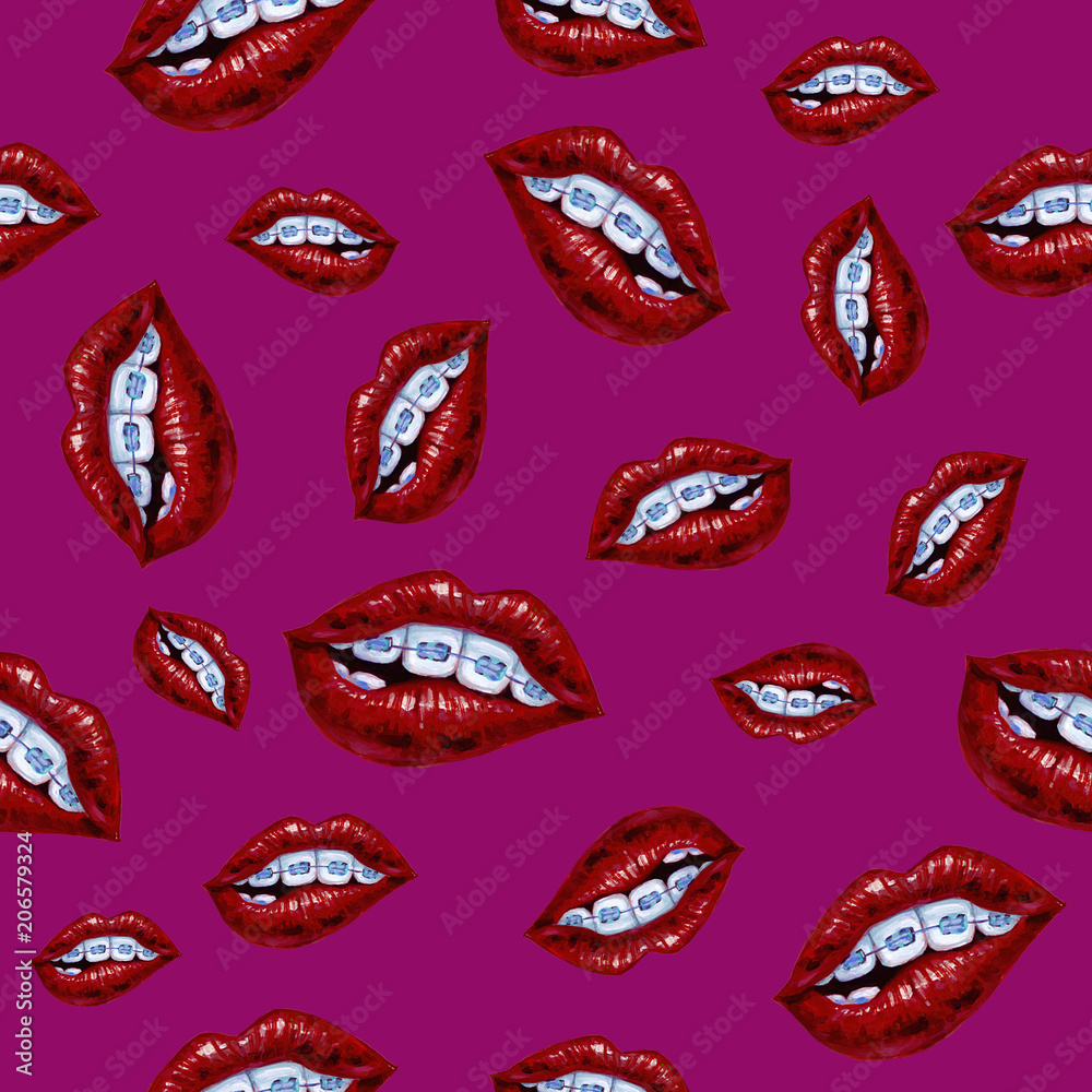 Fototapeta premium Illustration with lips and braces. Seamless pattern on a vinous background.