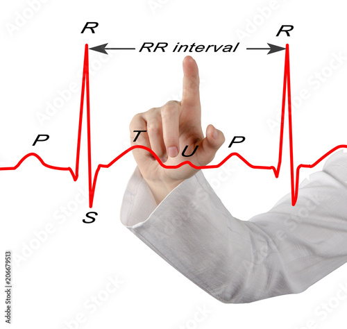 presenting marked ECG