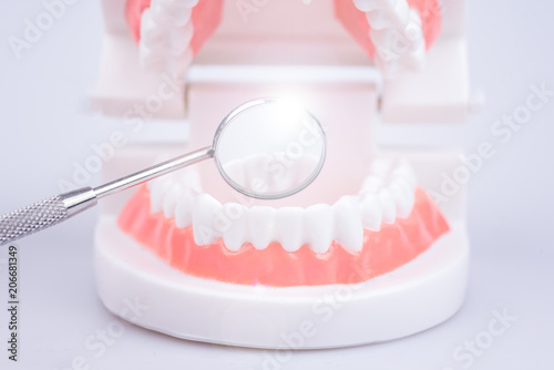 Zähne mit einem Zahnspiegel beim Zahnarzt