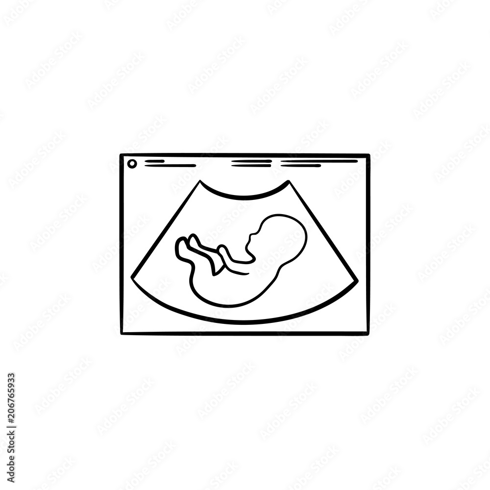 Fetal ultrasound hand drawn outline doodle icon. Pregnancy sonogram of