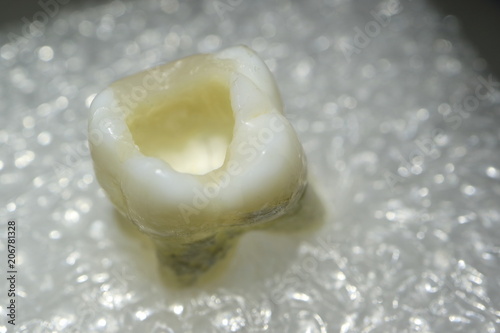 Picture of a human tooth.