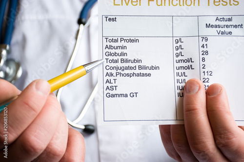 Analysis of bilirubin concept photo. Doctor holding laboratory test of liver function and indicates ballpoint pen on rate of total bilirubin. Raising or lowering level as indicator of liver disease