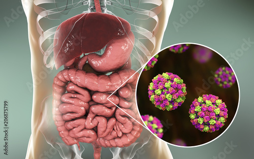 Norovirus in human intestine, also called winter vomiting bug, RNA virus from Caliciviridae family, causative agent of gastroenteritis with diarrhea, vomiting, stomach pain. 3D illustration photo