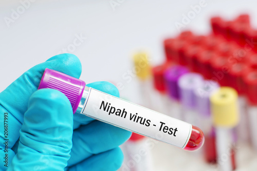 Test tube with blood sample for Nipah virus test 