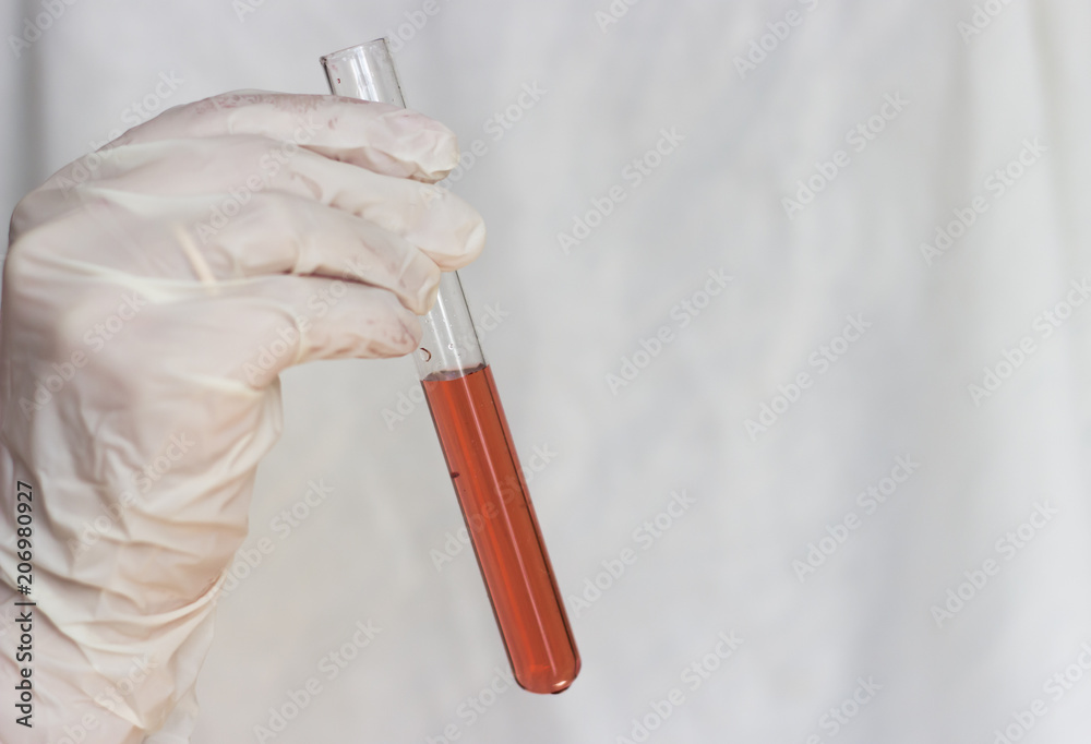 a hand in a glove holds a test tube with a red liquid a hand in a glove holds a test tube with a red liquid