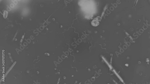 colony of bacteria spirochetes under a microscope photo