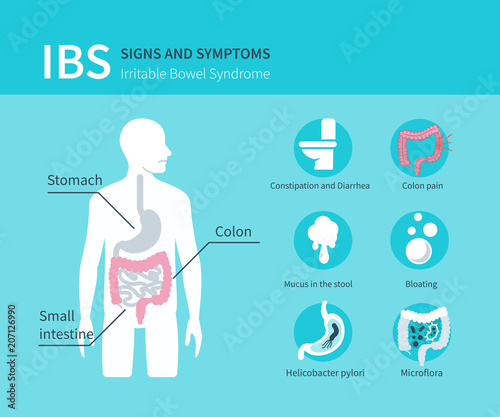 irritable bowel syndrome