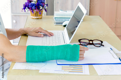 working woman with green cast on arm working on laptop in office, focus on broken hand