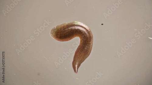 the leech under the microscope winds
