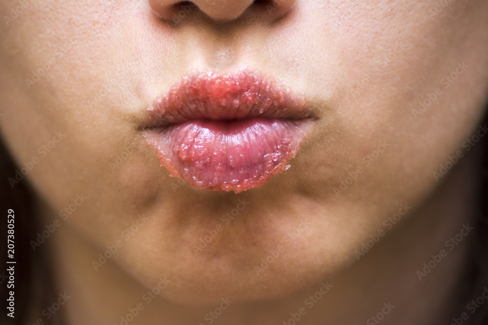 Naklejka premium Strawberry lip scrub made at home to exfoliate lips 
