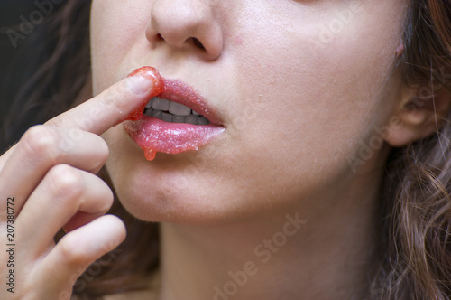 фотографія Strawberry lip scrub made at home to exfoliate lips