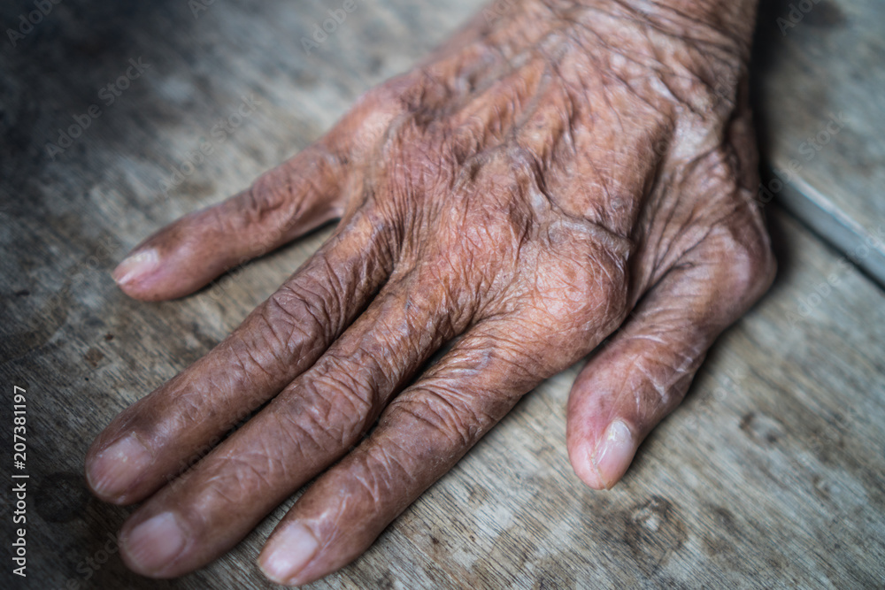Old Asian female hands full of freckles and wrinkles / Aging concept