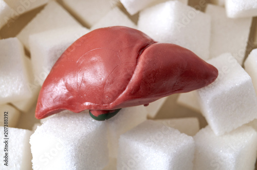 Foto Bad died and nonalcoholic fatty liver disease concept with a liver and sugar cub