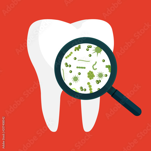 Vector illustration. Bacteria on a human white tooth being viewed on a magnifying glass.