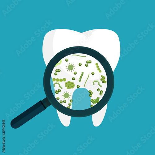 Vector illustration. Bacteria on a human white tooth being viewed on a magnifying glass.