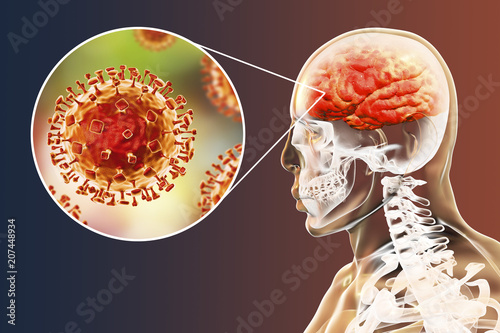 Nipah virus infection, newly emerging zoonotic infection with acute respiratory syndrome and severe encephalitis, 3D illustration