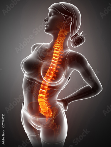 Women Feeling the Back pain
