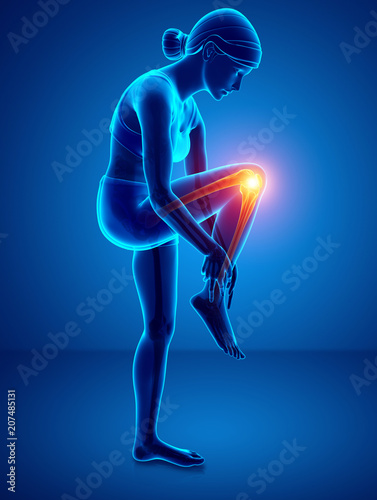 Women Knee joint pain