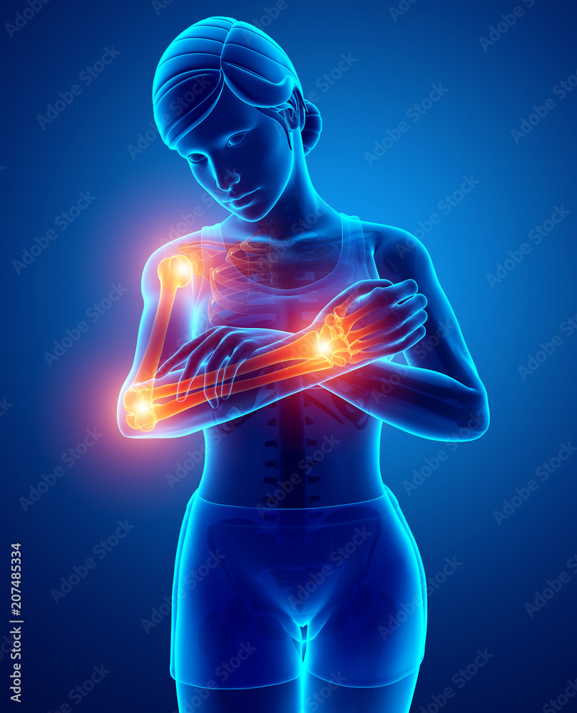 Women Feeling Arm joint pain Women Feeling Arm joint pain