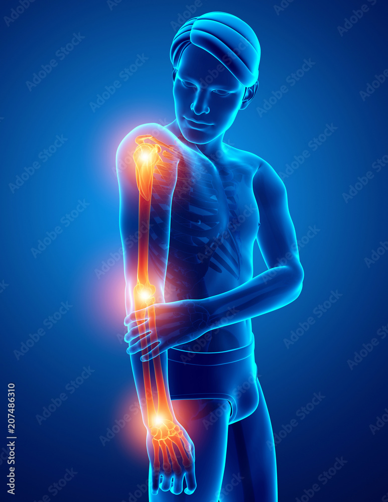 Men Feeling Arm joint pain Men Feeling Arm joint pain