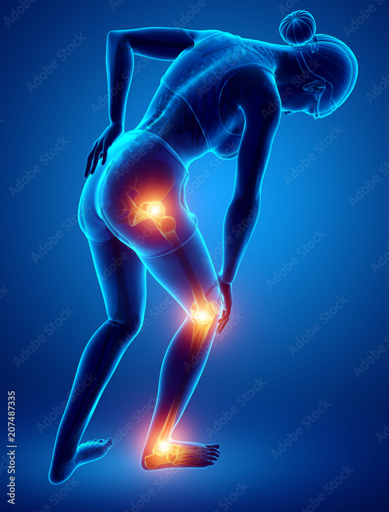 Female Leg joint pain