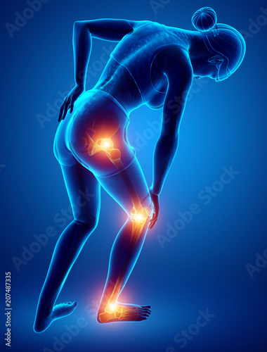 Female Leg joint pain