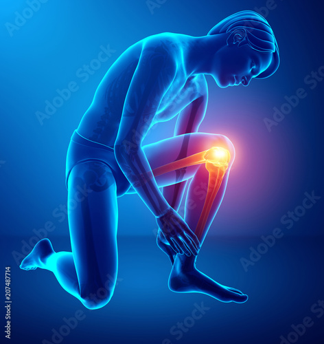 Male Knee pain
