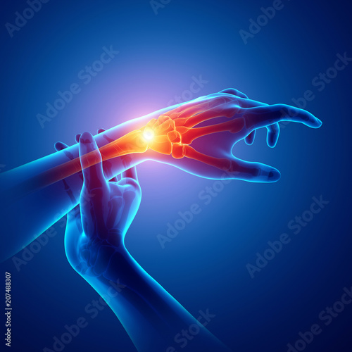 Men Feeling the Wrist Pain