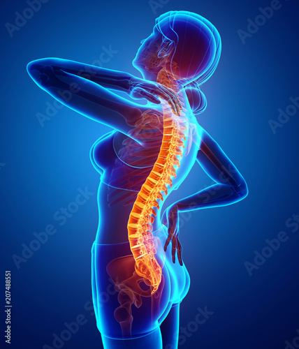 Women Feeling the Back pain