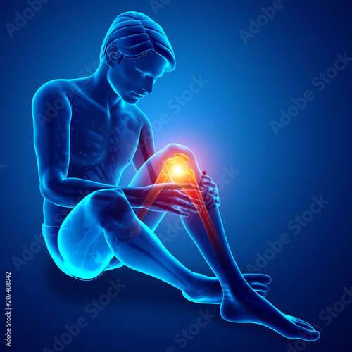 Male Knee pain