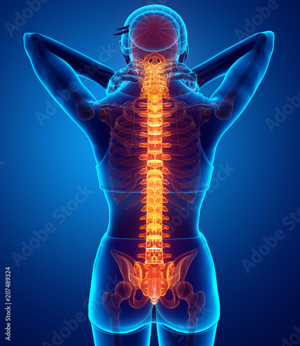 Women Feeling the Back pain