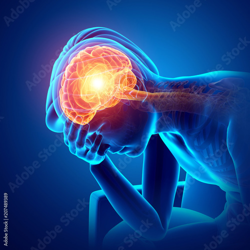 Male Feeling Headache