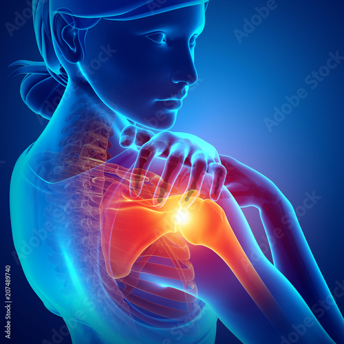 Women Feeling the Shoulder Pain