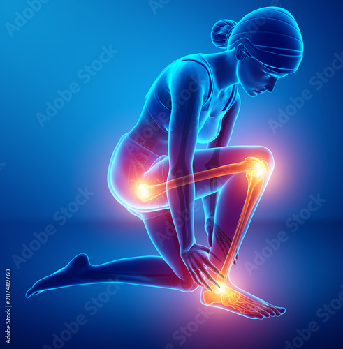 Pain in leg