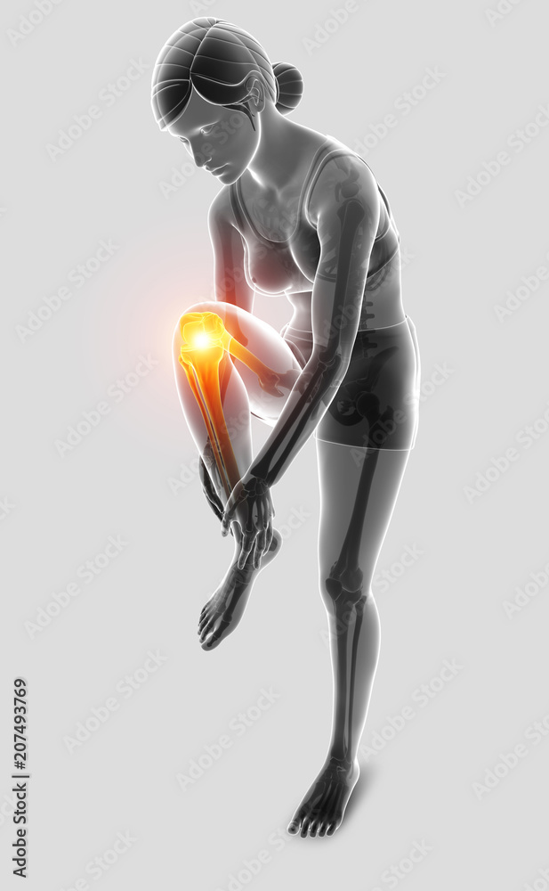 3d Illustration of Women feeling Knee pain