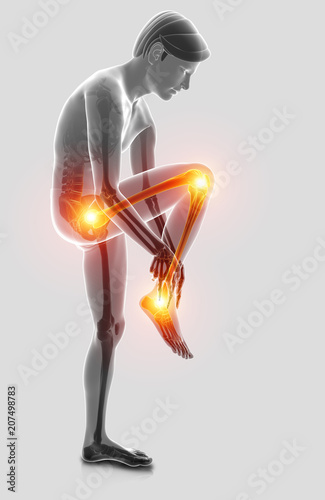 3d Illustration of Pain in leg