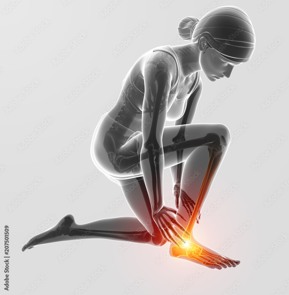 Obraz premium 3d Illustration of Female foot with ankle pain