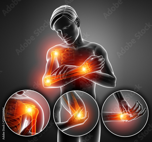 3d Illustration of Men Feeling Arm joint pain
